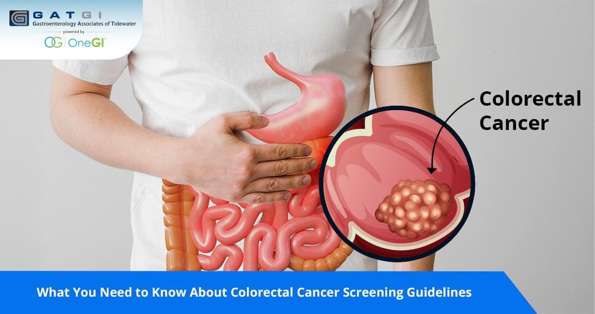 Colorectal Cancer Screening Guidelines