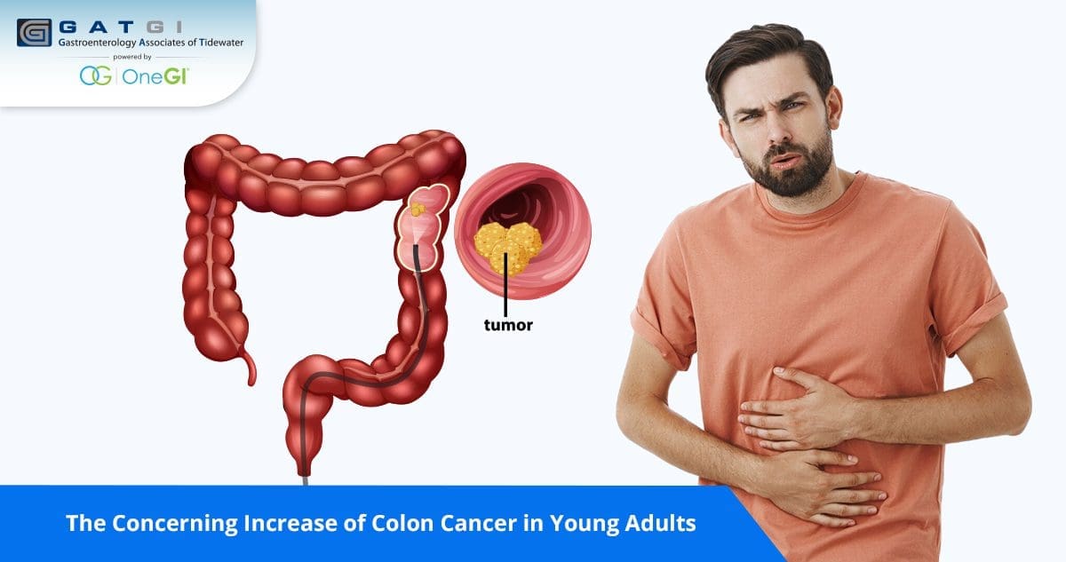 The Concerning Increase of Colon Cancer in Young Adults