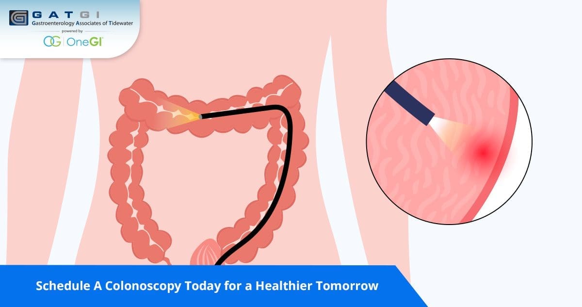Schedule A Colonoscopy Today for a Healthier Tomorrow