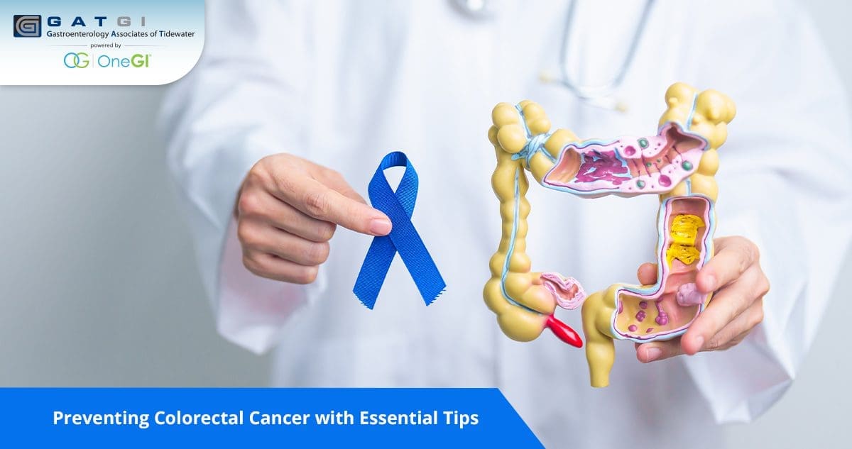 Preventing Colorectal Cancer with Essential Tips