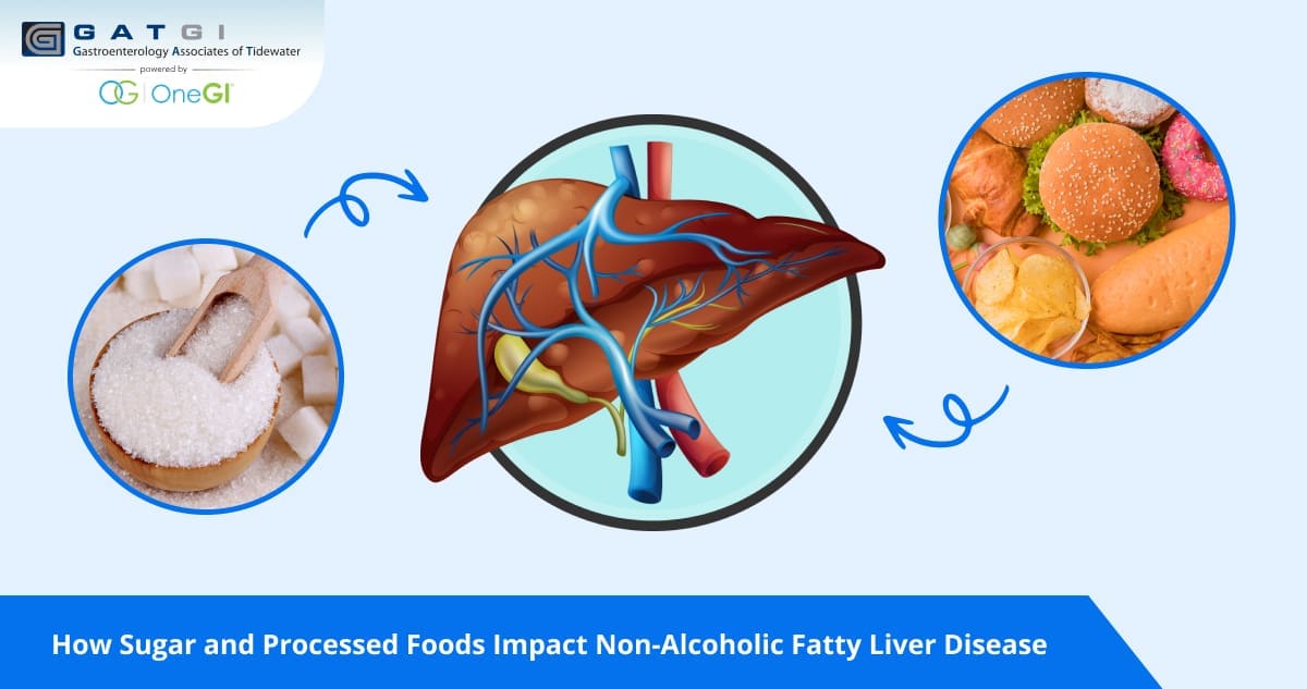 How Sugar and Processed Foods Impact Non-Alcoholic Fatty Liver Disease